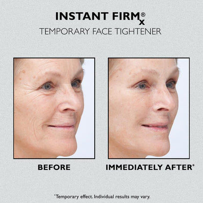 Temporary Face Tightener