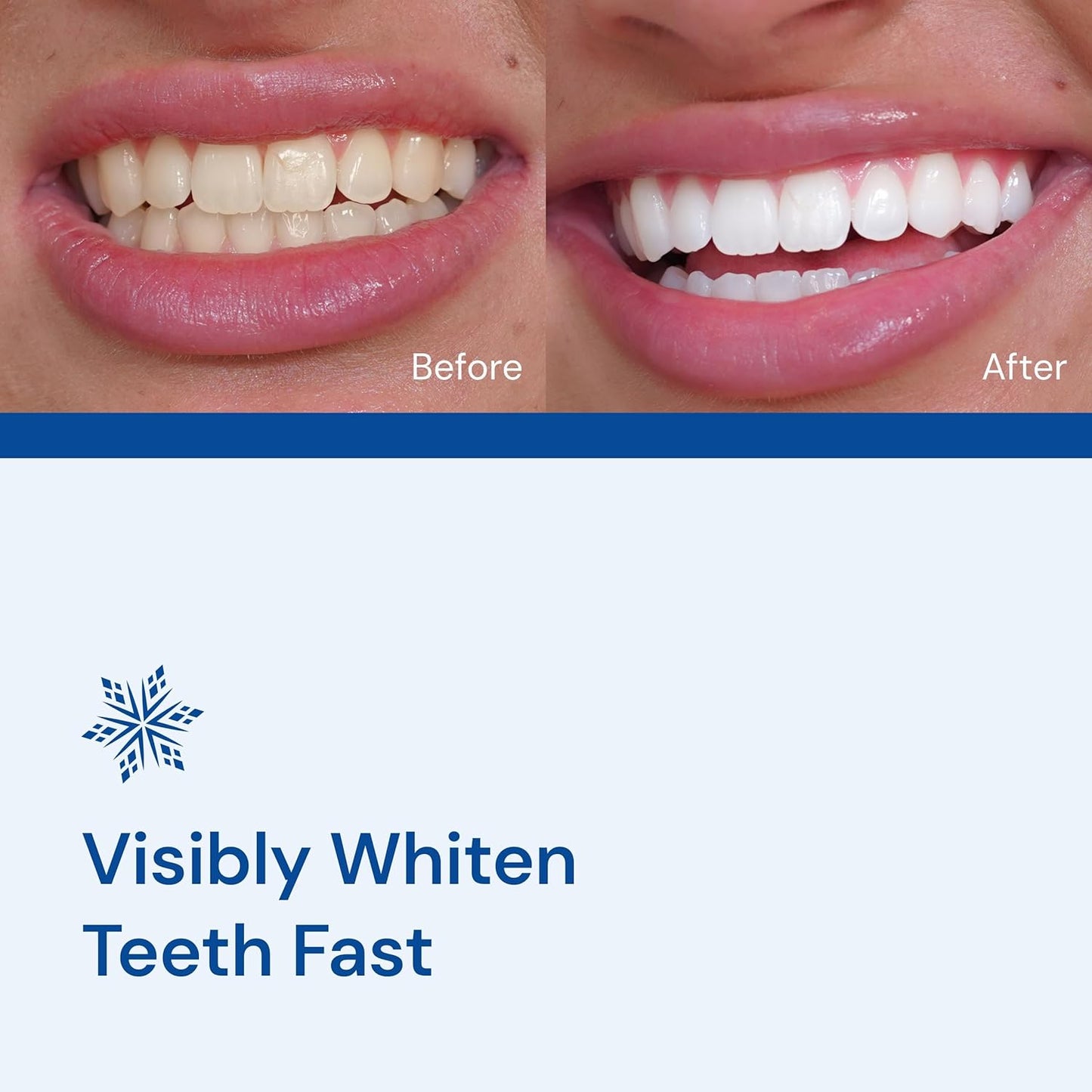 SNOW Diamond Teeth Whitening Strips